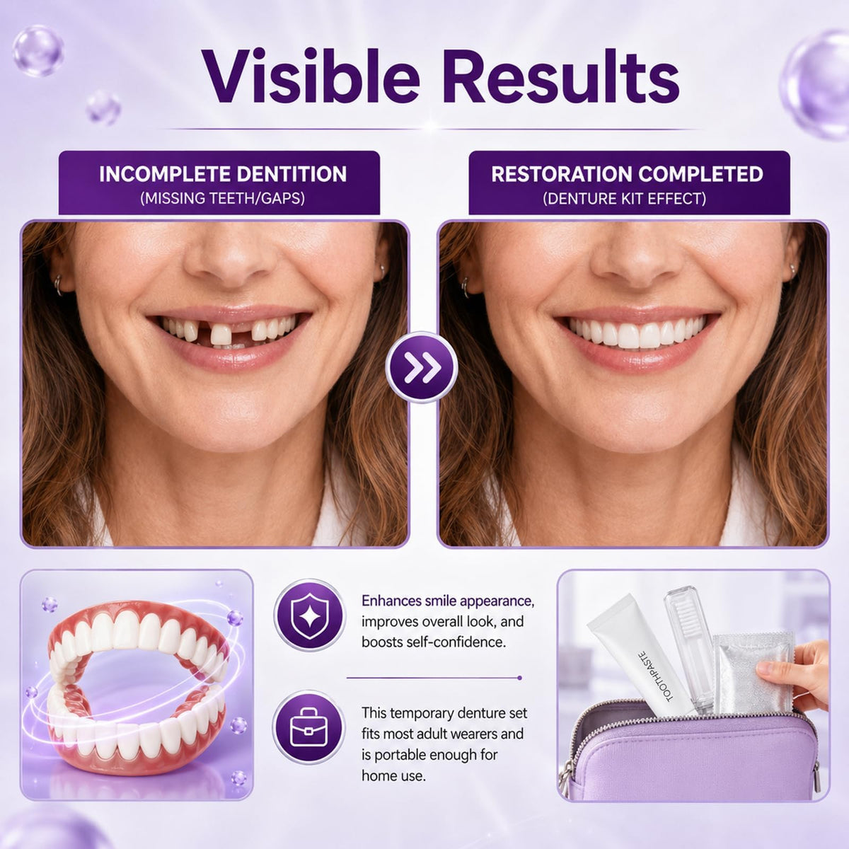 Heat Moldable Temporary Denture Kit 1 Set J27660